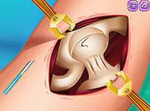 Princess Hips Surgery Online Game